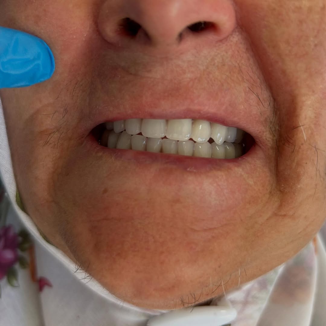 Diş Hekimi Hande Orhan, Hastasına Yeni Protezini Teslim Etti