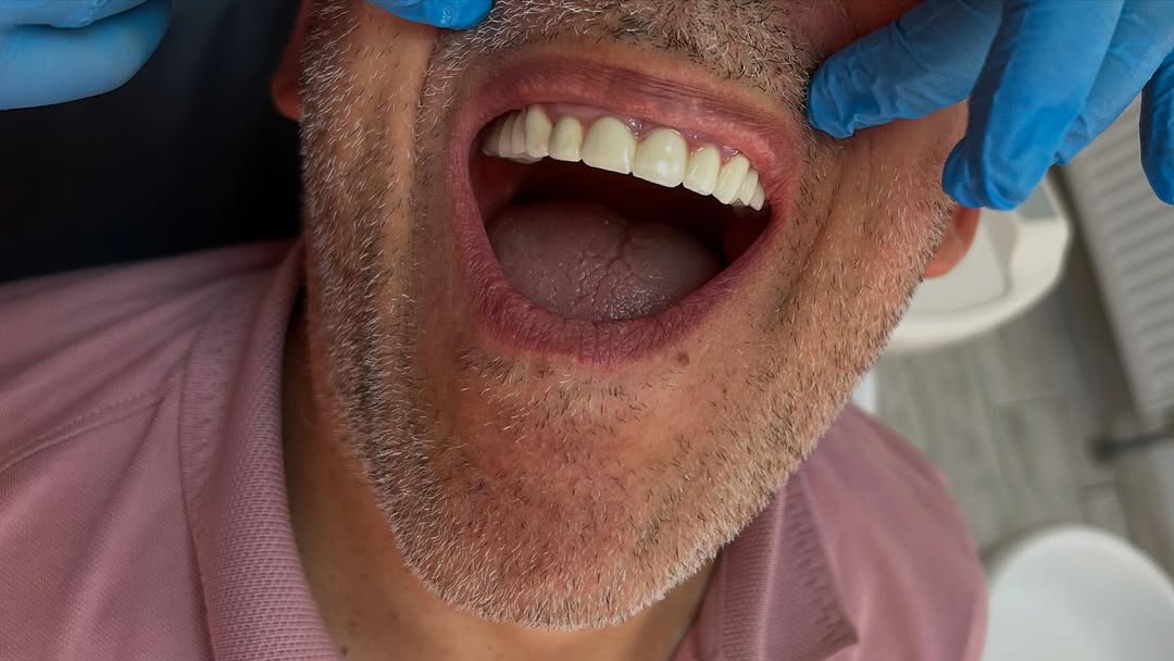 Diş İmplantı ve Protez Tedavilerinde Uzman Diş Hekimi