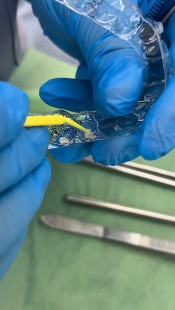 Şeffaf Plak Tedavisiyle Güzelliğe Gülümsün: Afyonkarahisar'da Yeni Bir İmkan