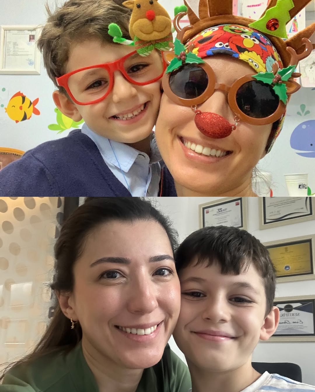 Çocuk Diş Tedavilerinde Uzun Vadeli Başarı: Düzenli Kontrollerin Önemi