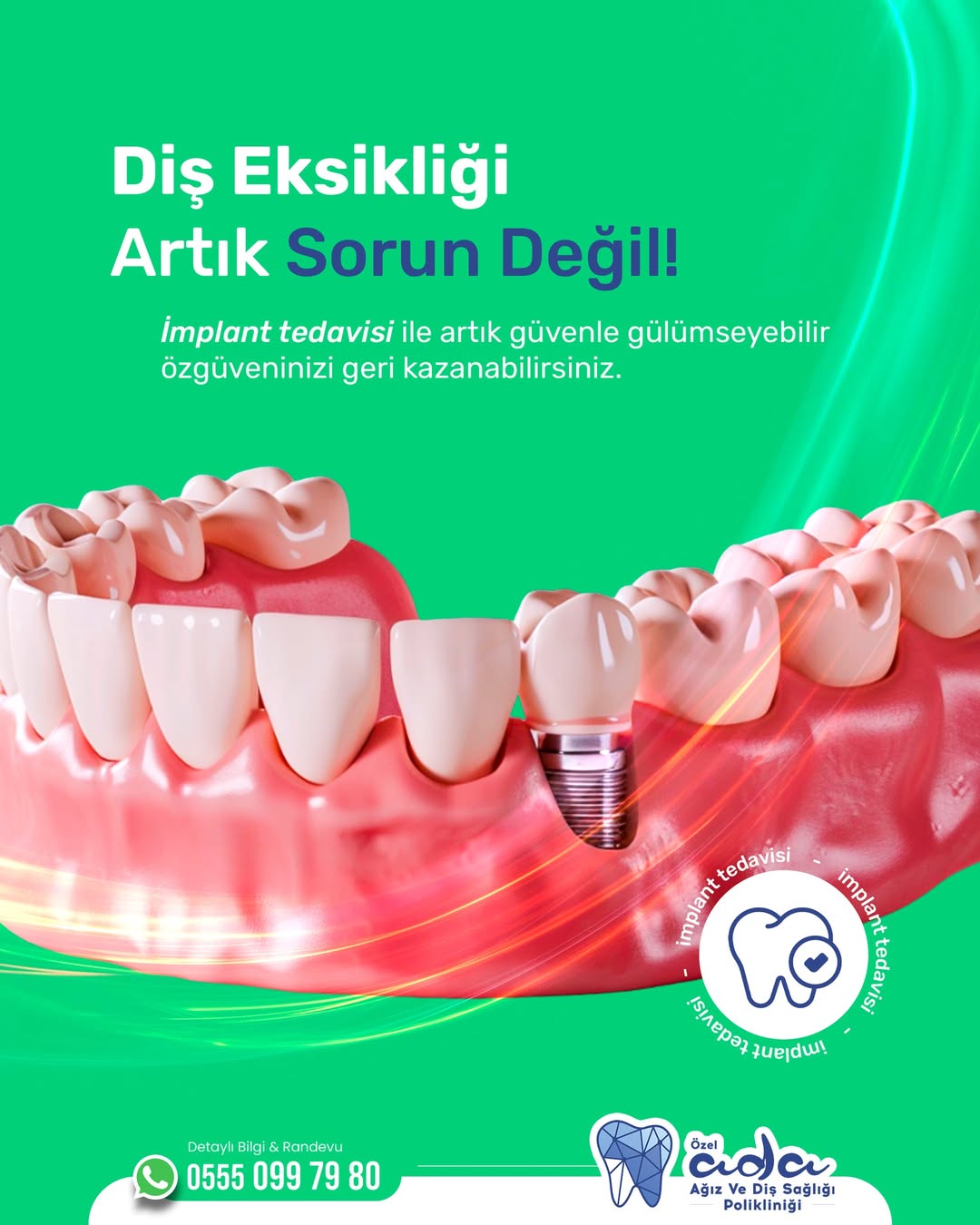 Ada Diş Polikliniği'nde İmplant ve Estetik Çözümlerle Eksik Diş Sorununa Son