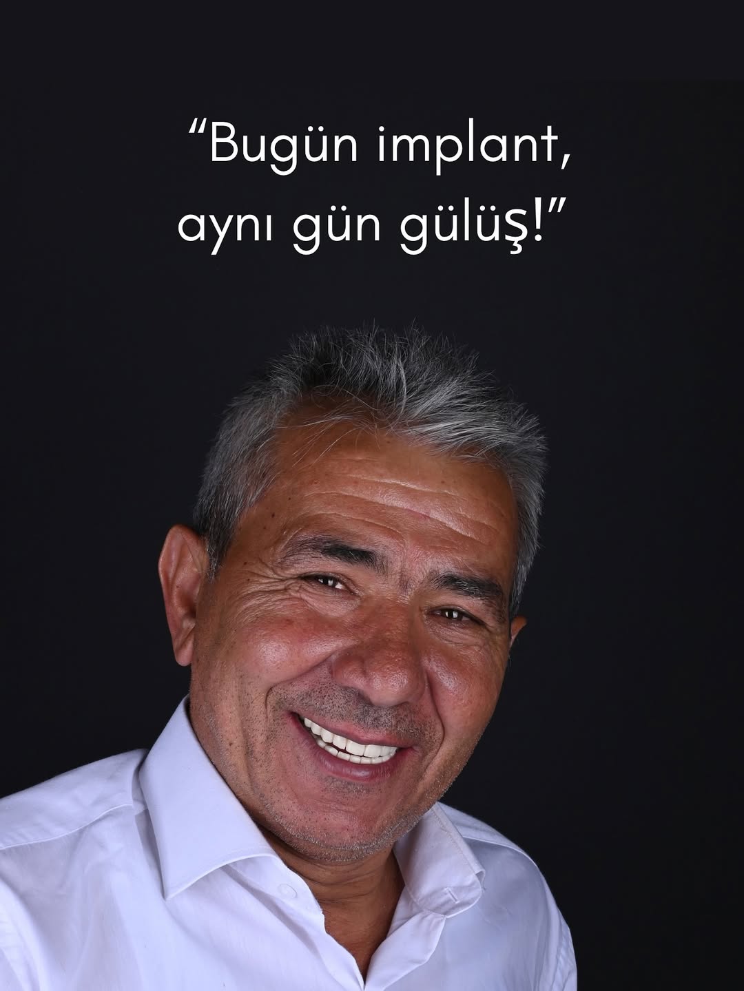 İmplant Tedavisinde Aynı Gün Geçici Protez Uygulamasıyla Dişsiz Kalmadan Gülümseyin