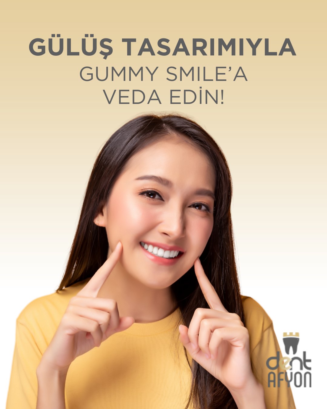 Gummy Smile Tedavisi ile Özgüvenli Gülümseme