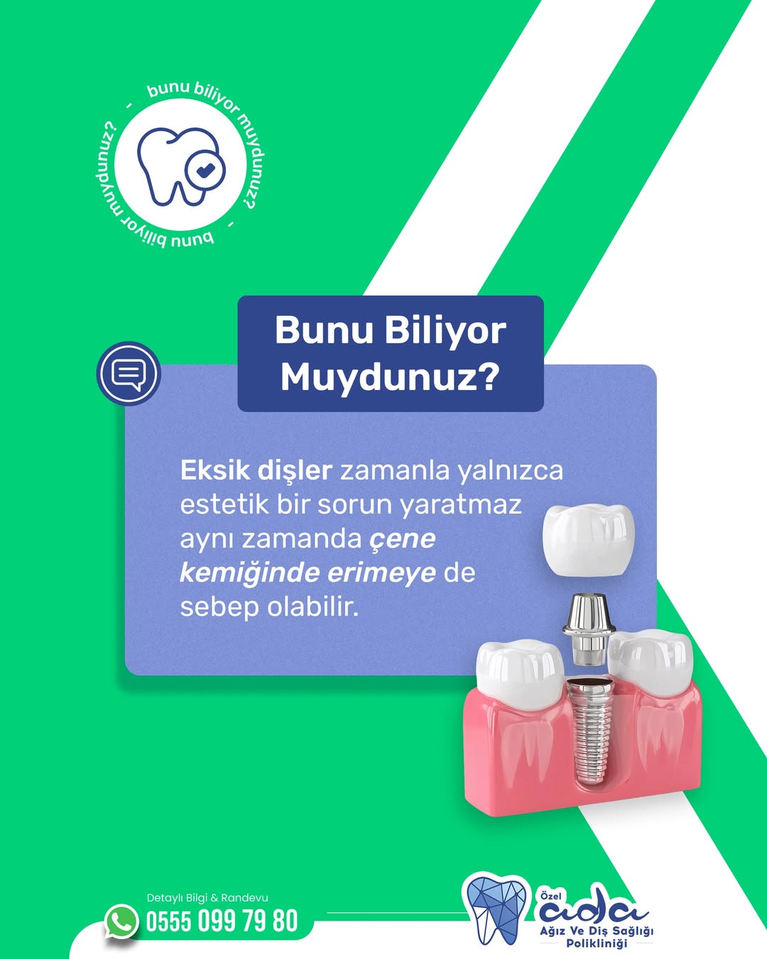 Eksik Dişler Sağlık Sorunlarına Yol Açabilir: Ada Diş Polikliniği Çözüm Sunuyor
